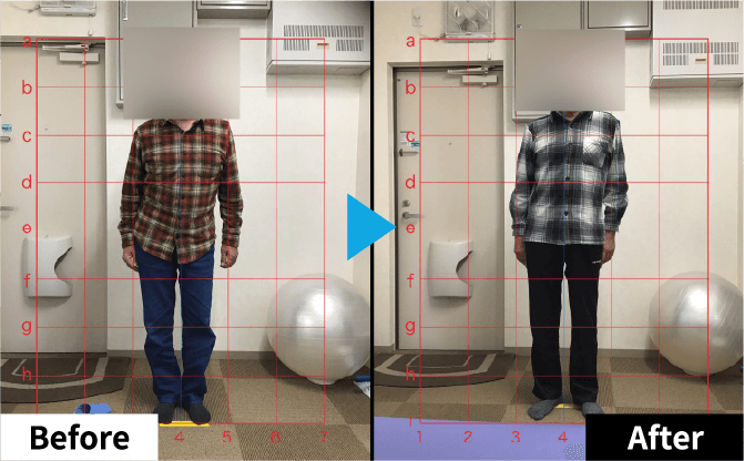 Improvement Example 01