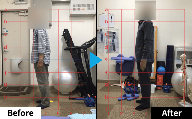 Improvement Example 03