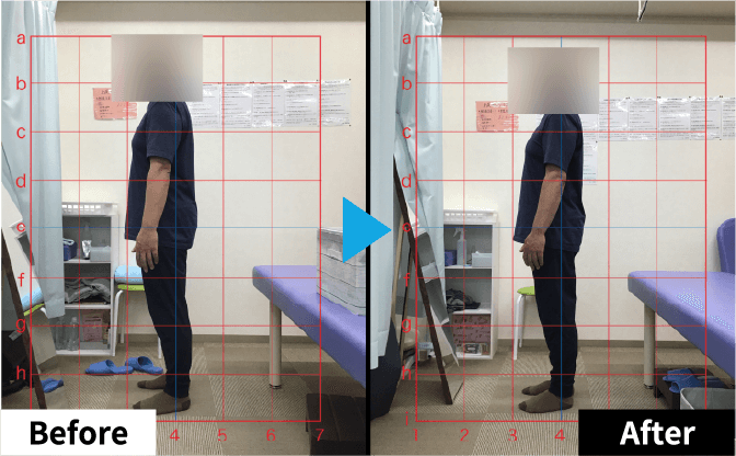 Improvement Example 04