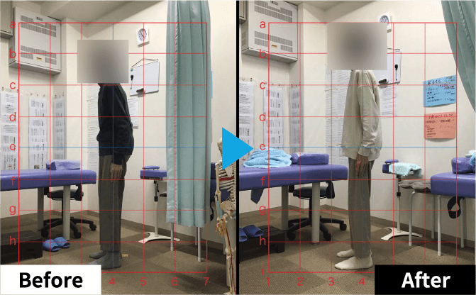 Improvement Example 05
